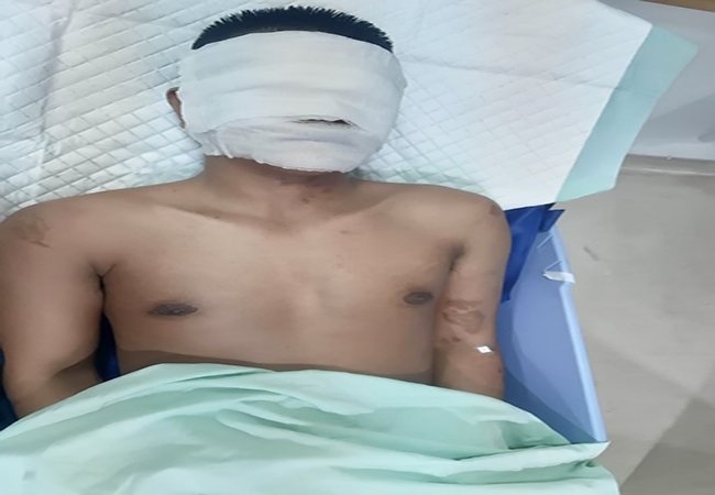 Pimpinan Media Online Jelajah Perkara Disiram Air Keras OTK