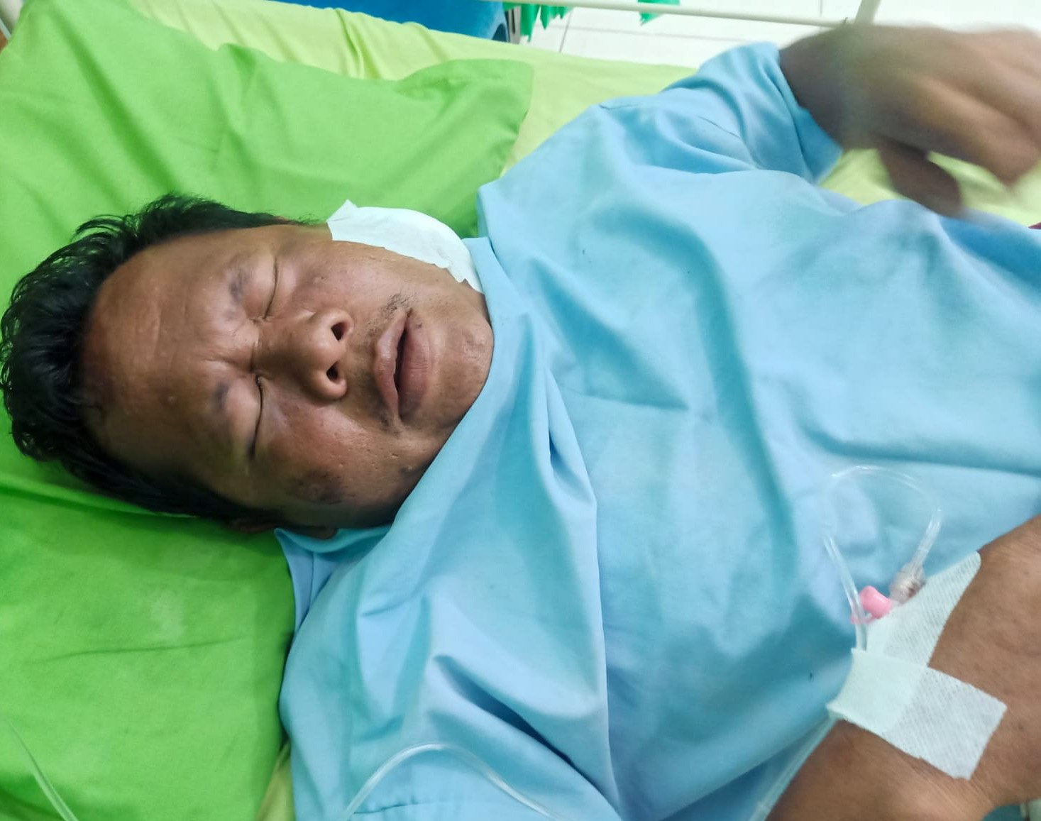 Jukir Penghalau Perampok Emas Terkapar,