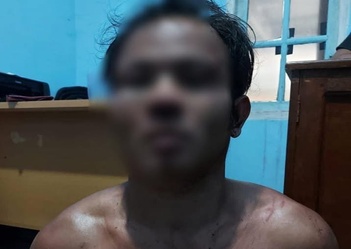 Mengerikan, Seorang Pemuda Gorok Leher Ayahnya Hingga Putus