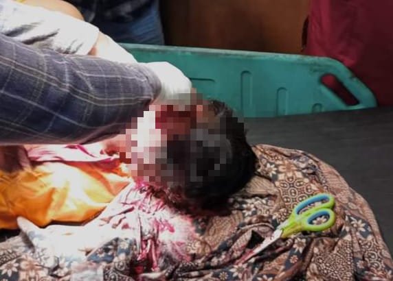 Ngeri, Terjadi Pertikaian Warga Tiga Panah dengan Kelompok Diduga Preman