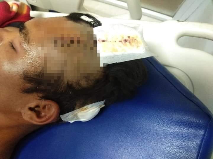 Mencekam! Warga Dibacok Motor Dibakar, Warung Dirusak: Pelaku Belum Ditangkap