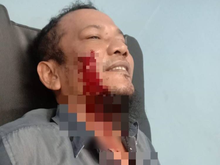 Breaking News! Seorang Wartawan Diteror dan Disayat OTK