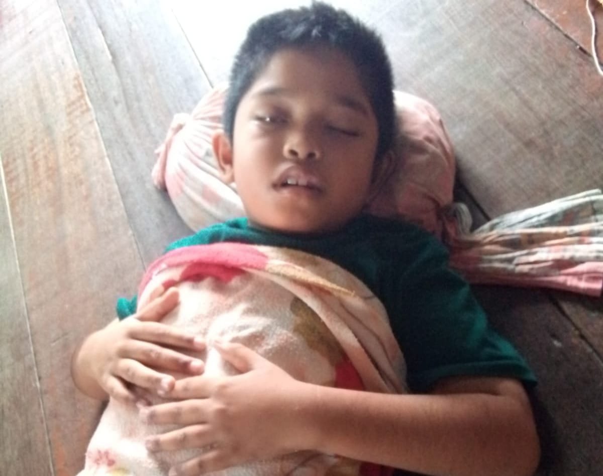 Derita Tumor Otak, Anak di Sergai Butuh Uluran Tangan