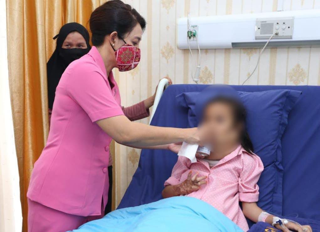 Istri Kapoldasu Jenguk Anak Korban Luka Bakar, Diminta Pelaku Ditahan