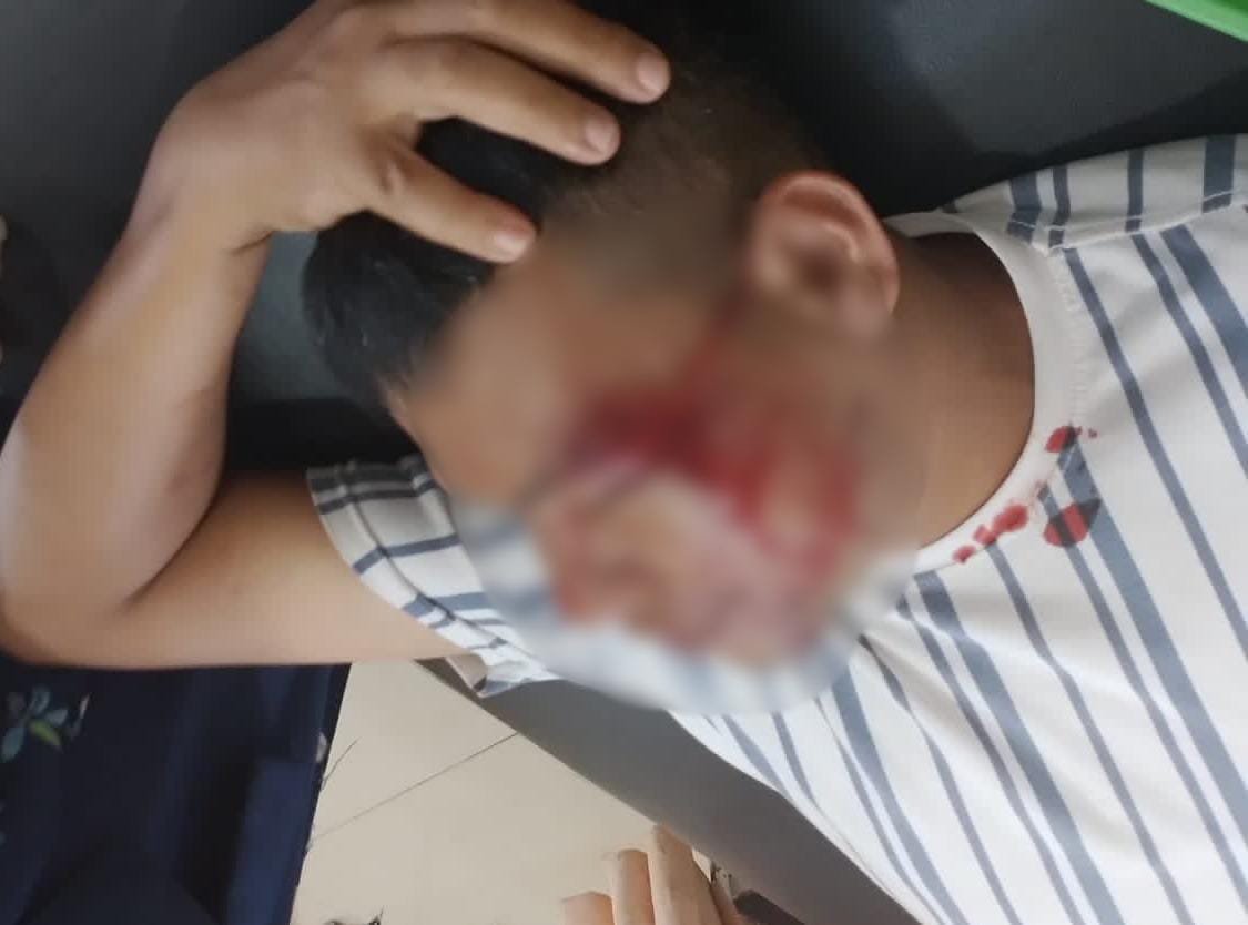 Penertiban PKL Jalan Thamrin Telan Korban, Pemko Sidempuan Dituding Pilih Kasih