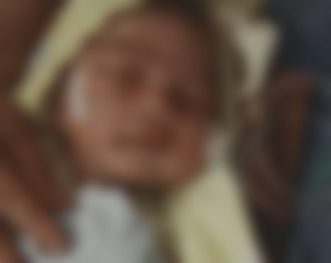 Terkendala Biaya Rumah Sakit, Bayi Dionisius Zega Butuh Uluran Tangan