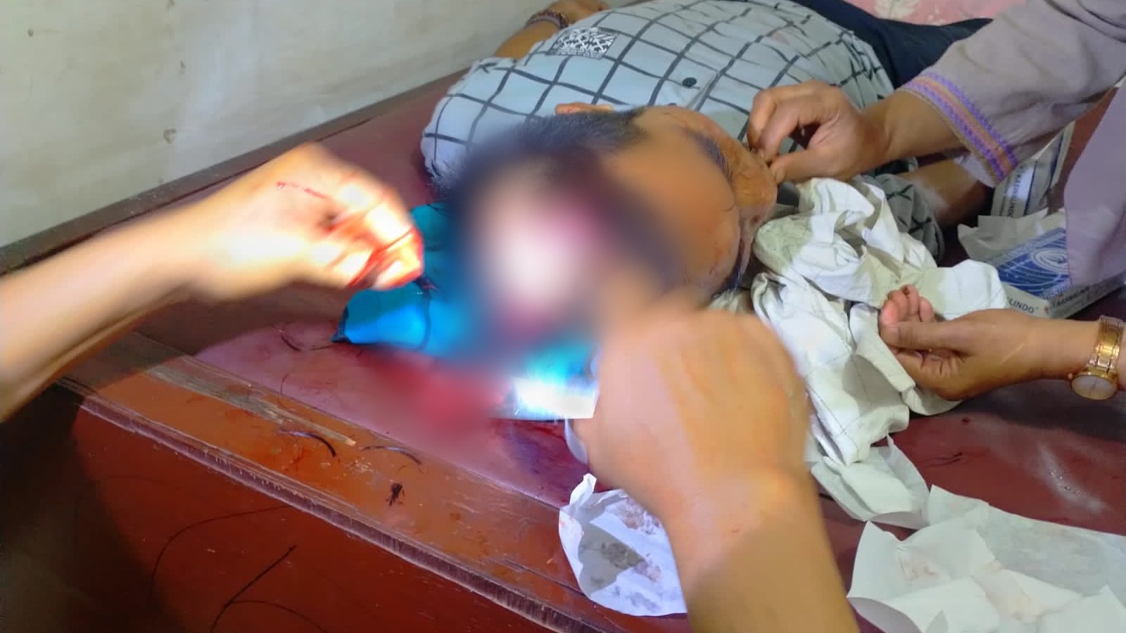 Kades Sijungkang Tapsel Dibacok Warganya, Akibatnya Luka Sobekan 15 Jahitan