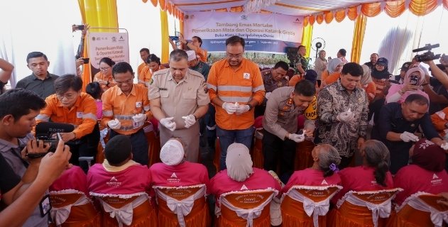 Ikuti Operasi Katarak Gratis PTAR, Warga Tapsel Kini Bisa Lihat Indahnya Dunia