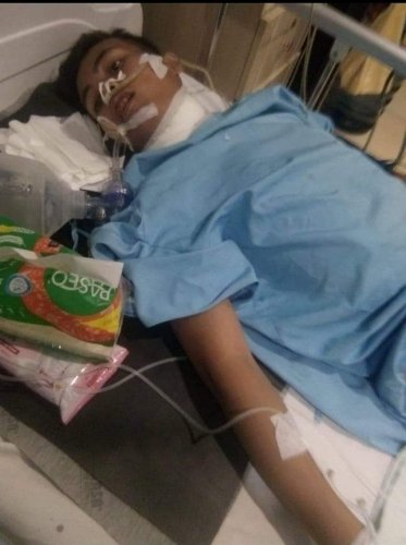 Kejam! Santri di Tapsel Lehernya Disayat Pakai Pisau Kater, Korban Mohon Kapolda Beri Keadilan