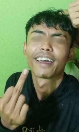 Miris! Difitnah Selingkuh, Wanita ini Alami KDRT Hingga Kepala Bocor dan Lembam