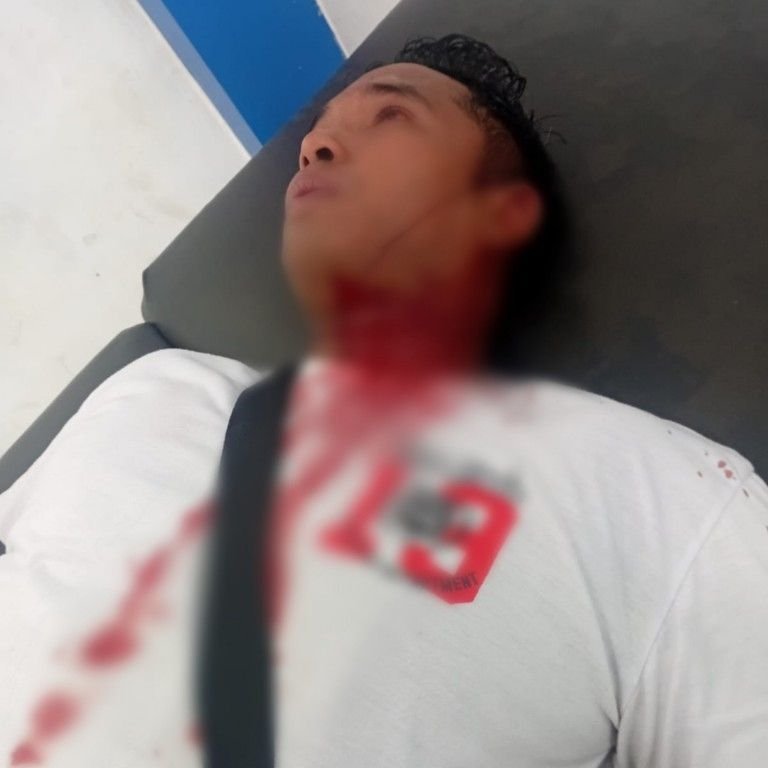 Minta Uang Keamanan, Penjual Bakso Keliling Dibacok di Depan SMP 1 P.Sidimpuan