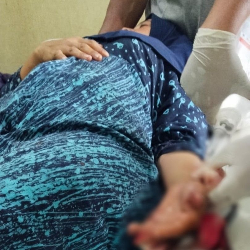 Duel dengan Rampok, Tangan IRT Batunadua di Parang, Uang dan Motor Dibawa Kabur