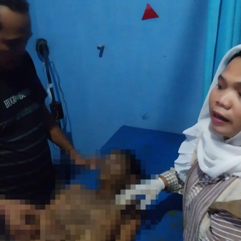 Tragis di Batang Toru ! Tersambar Petir Saat Makan Tebu, Korban Sempat Ditimbun Tanah oleh Teman